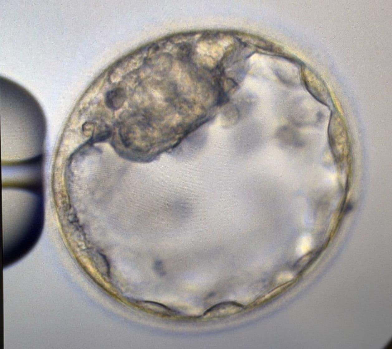 Egg Freezing treatment at Palm Beach Fertility Center in Boca Raton, FL